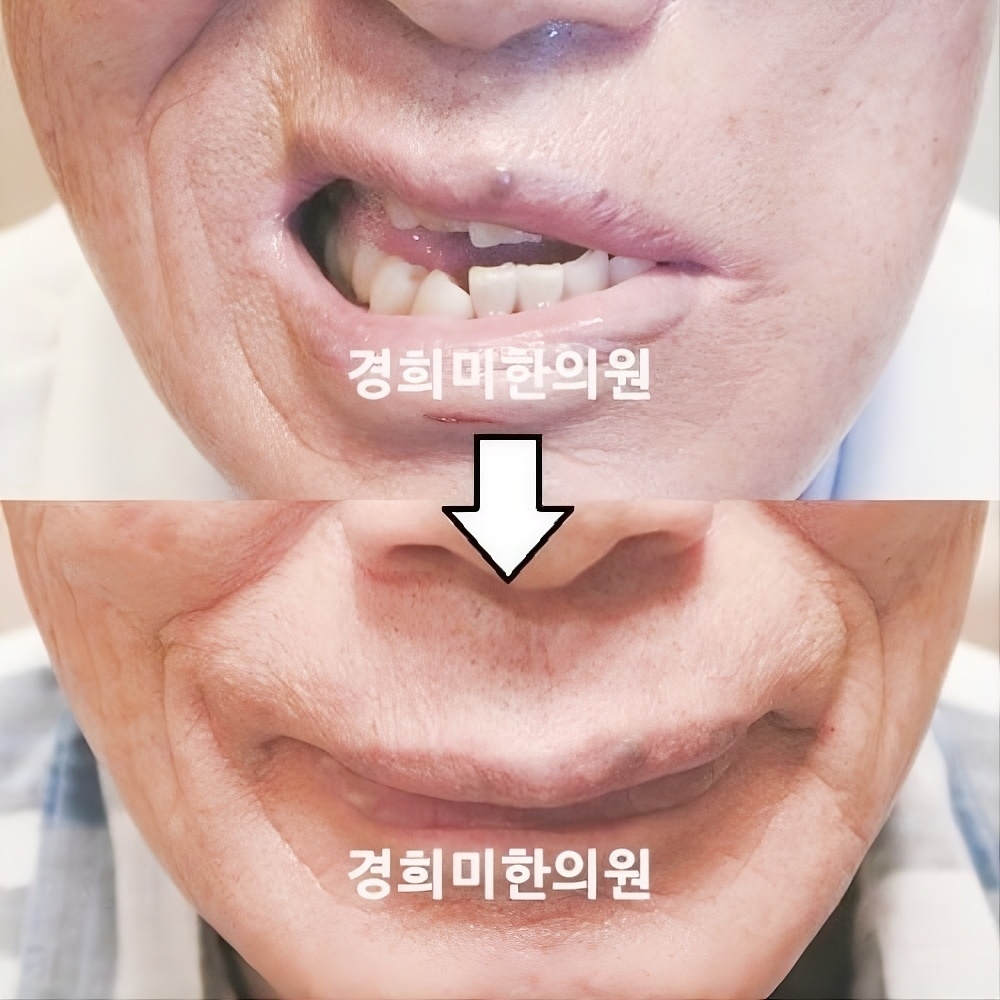 15번-20986.jpg
