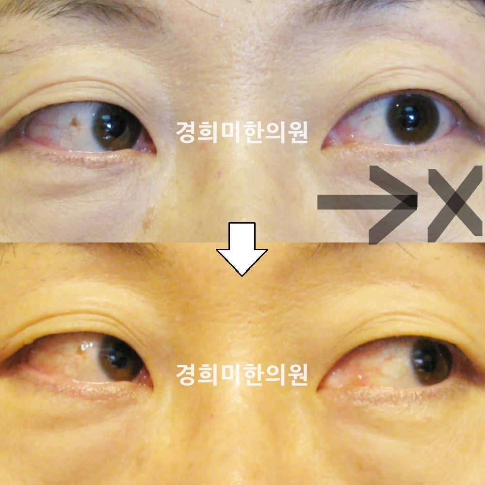 21번-12789-강약-표시.jpg