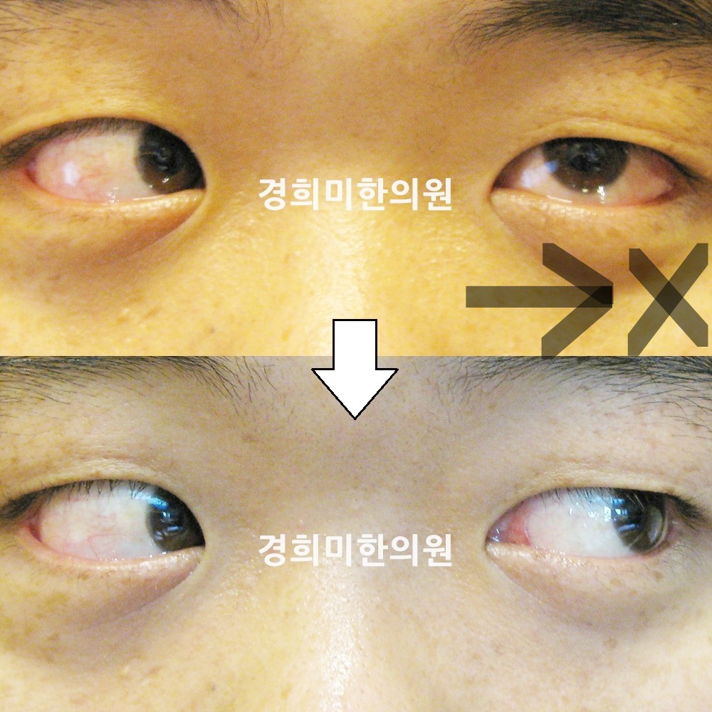 25번-13107-강강-표시.jpg