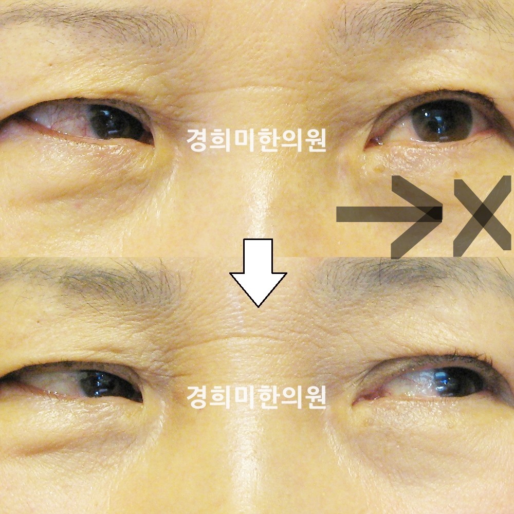 26번-13028-강중-표시.jpg