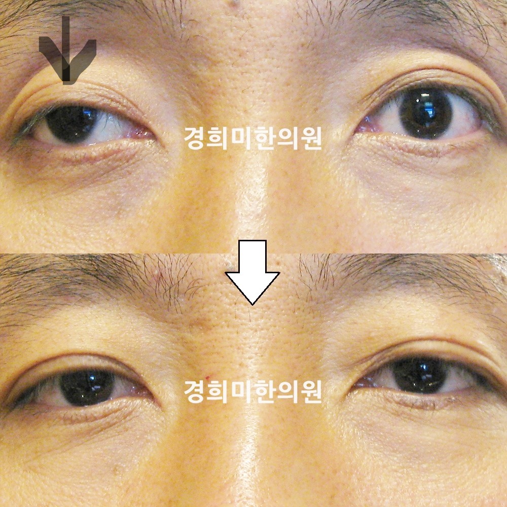 27번-13273-강강-표시.jpg