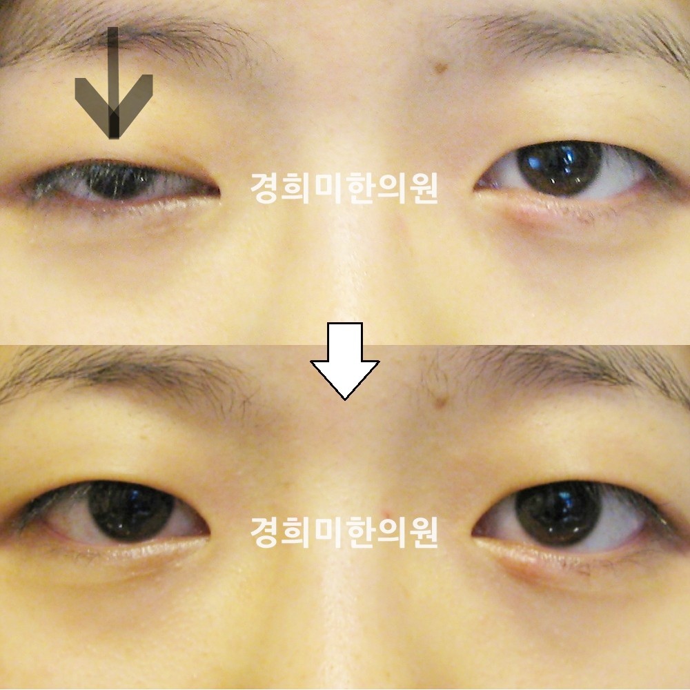 28번-13294-강중-표시.jpg