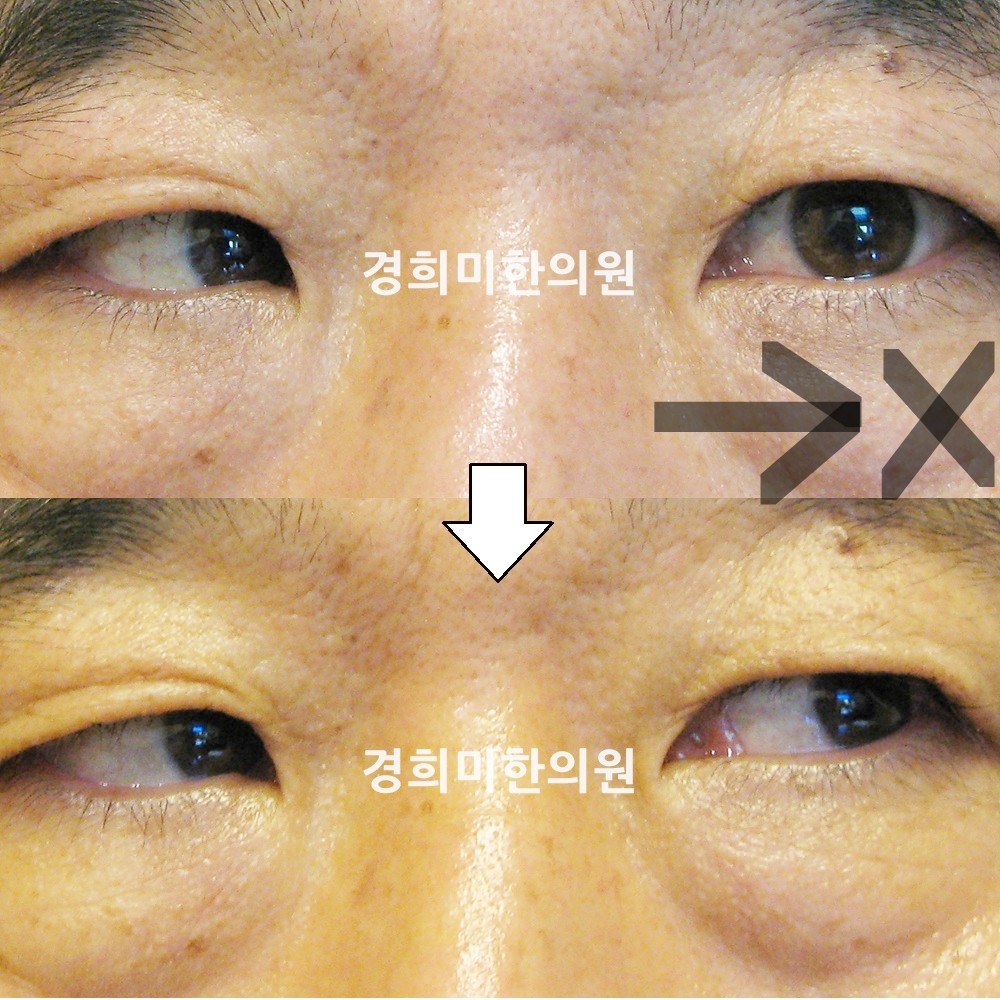 29번-13171-강중-표시.jpg