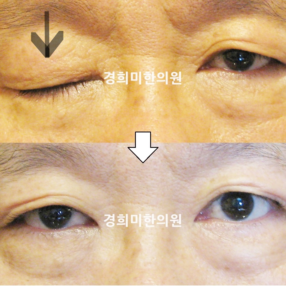 31번-13524-1-강강-표시.jpg