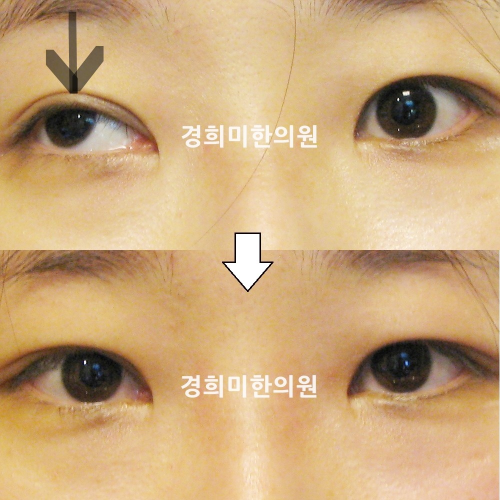 33번-13569-강중-표시.jpg