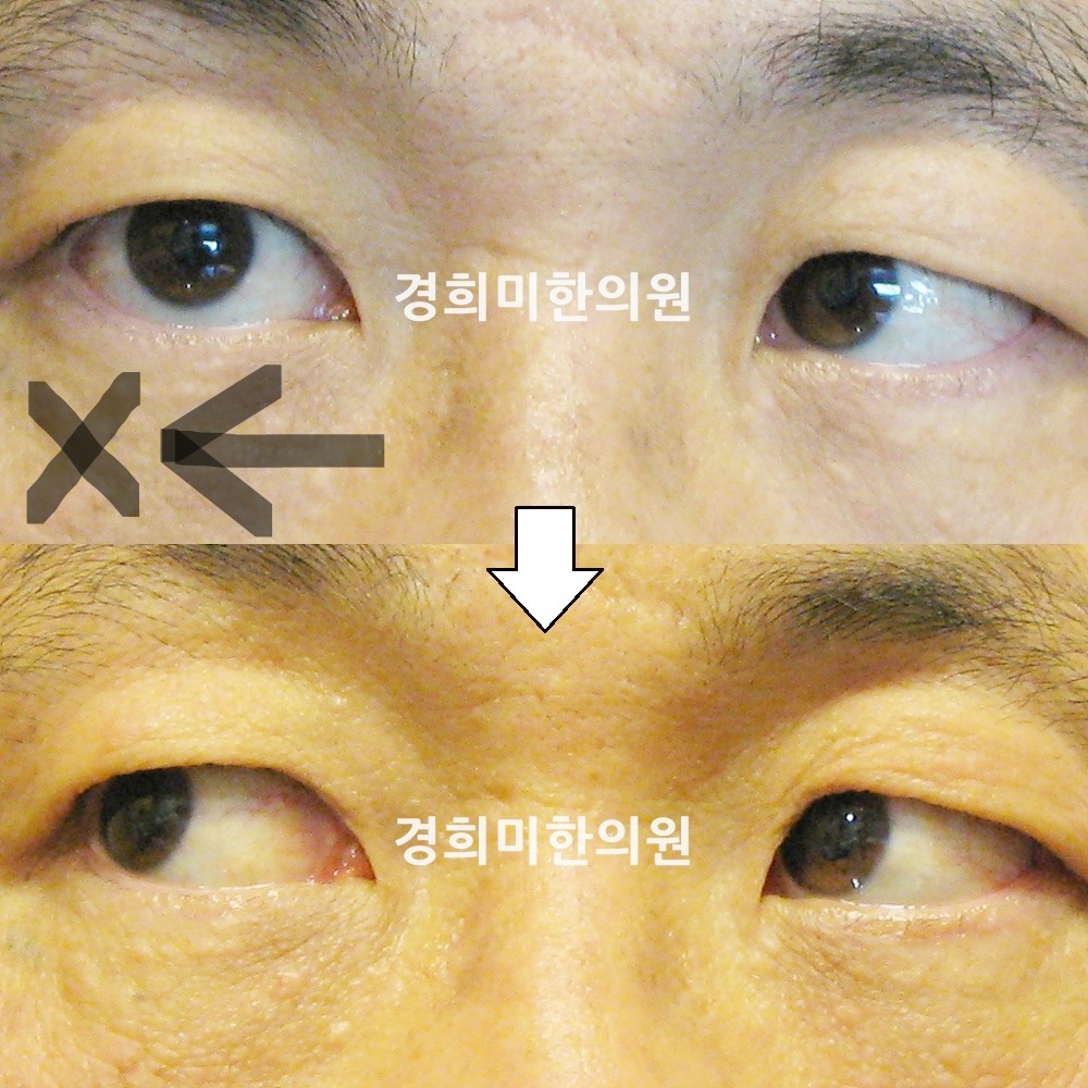 34번-13610-강중-표시.jpg