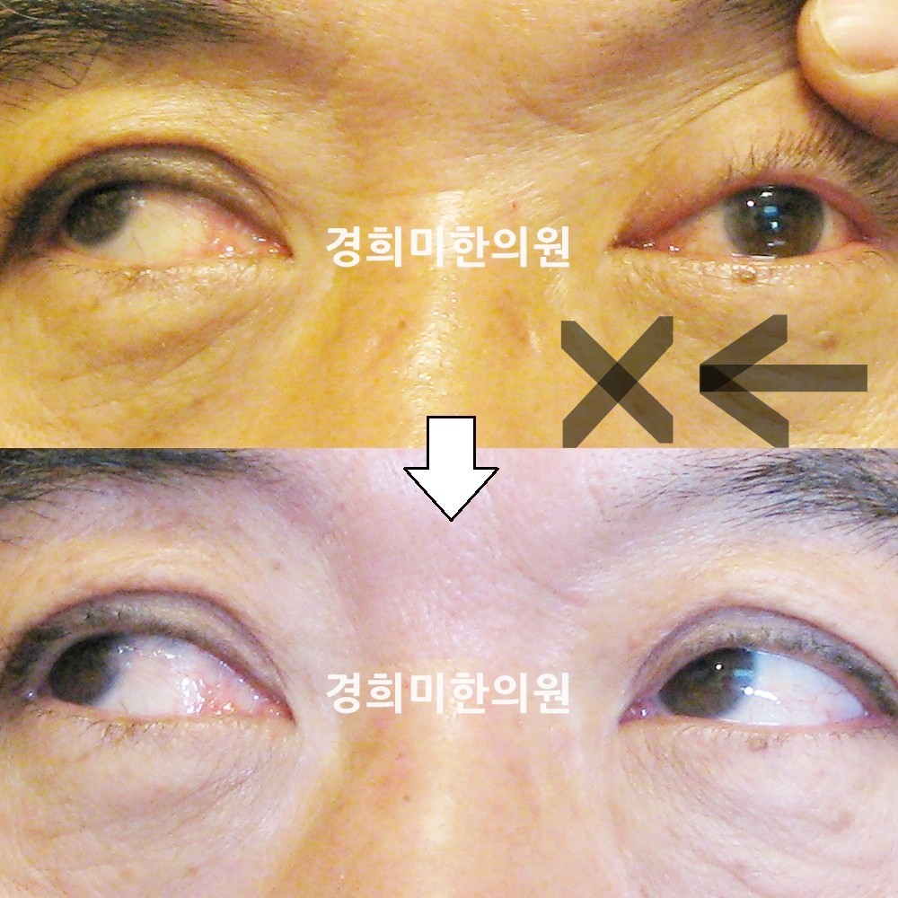 37번-13497-2-강강-표시.jpg