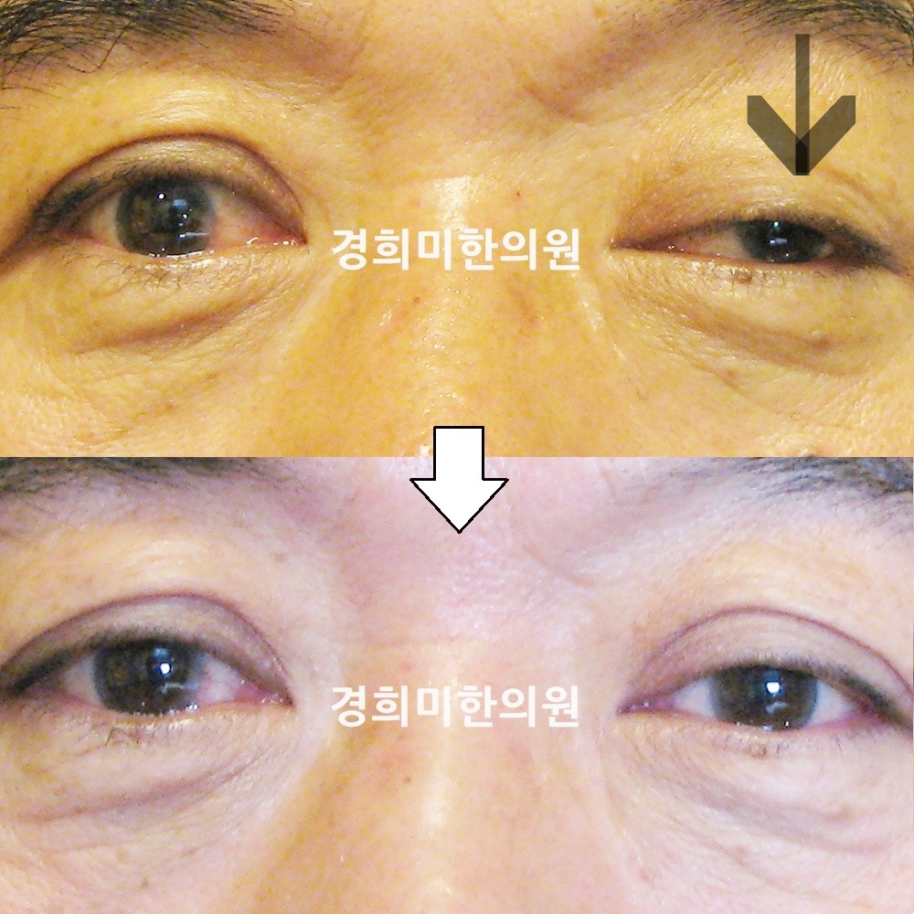 37번-13497-1-강강-표시.jpg