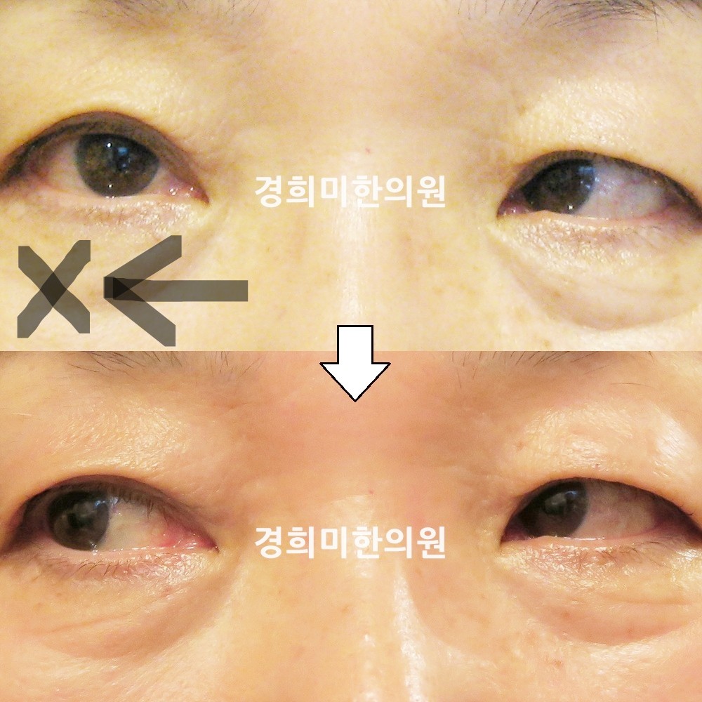 38번-13768-강중-표시.jpg