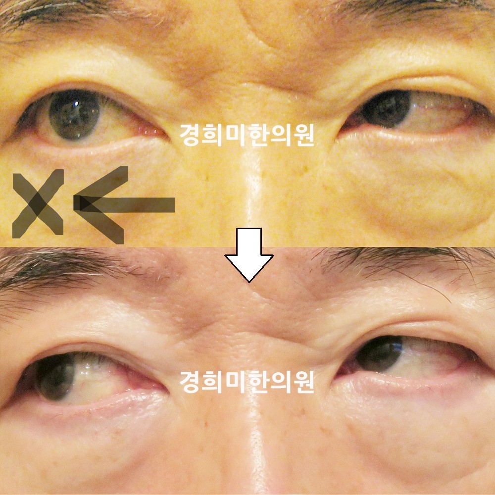 39번-13832-강강중-표시.jpg