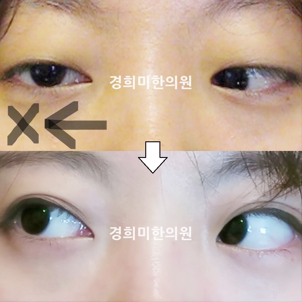 40번-13843-1-강중-표시.jpg