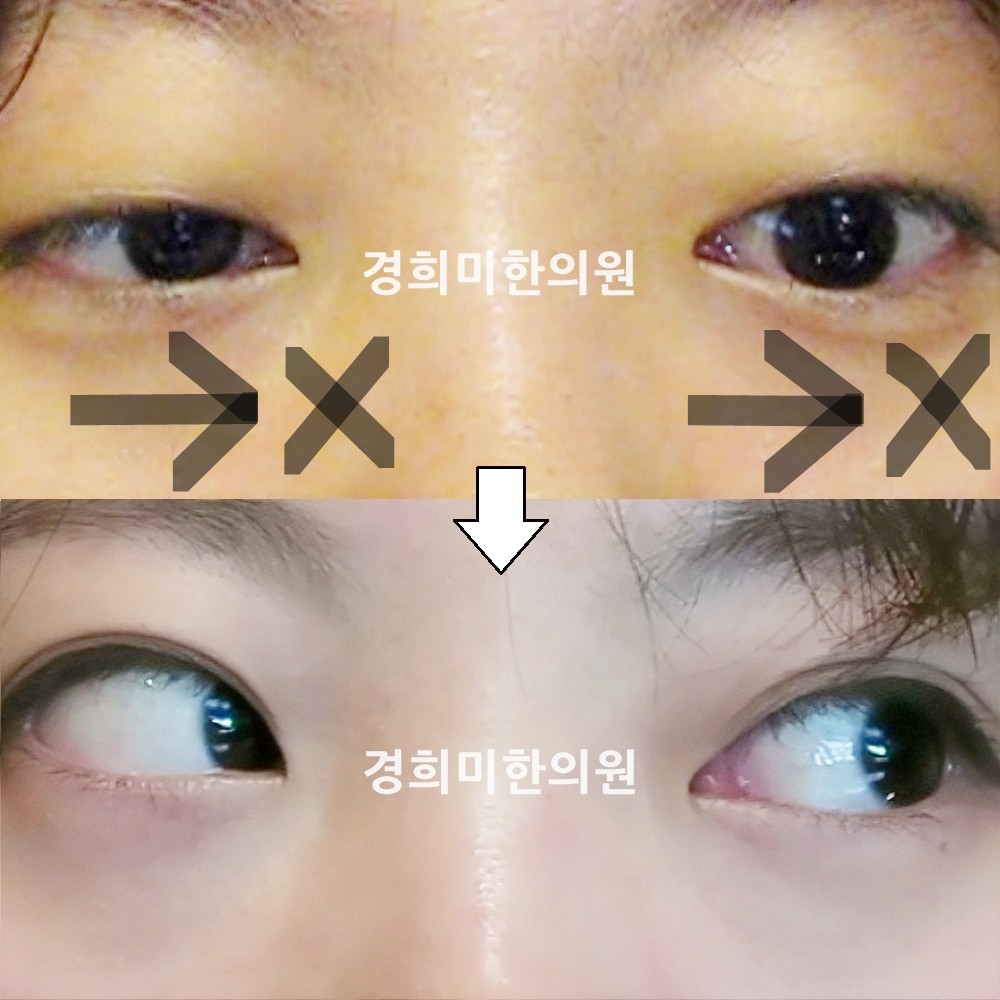 40번-13843-2-강중-표시.jpg