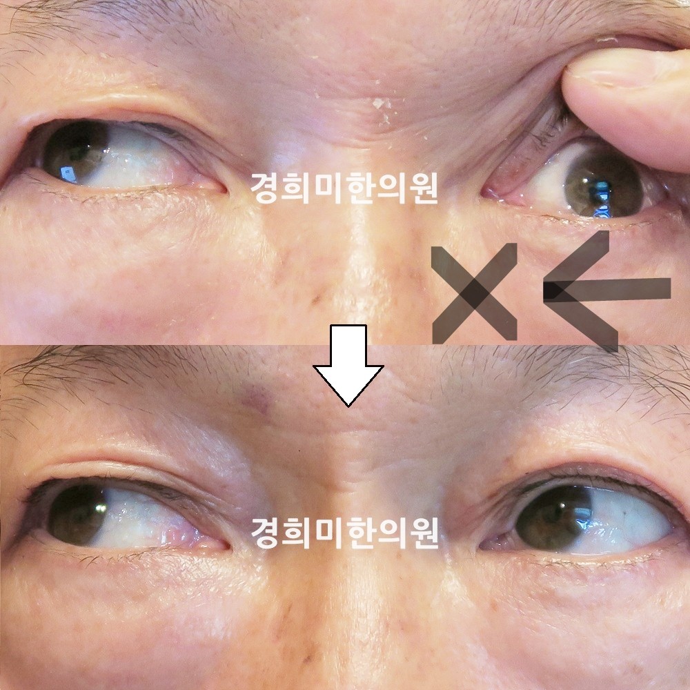 42번-13953-2-강강-표시.jpg