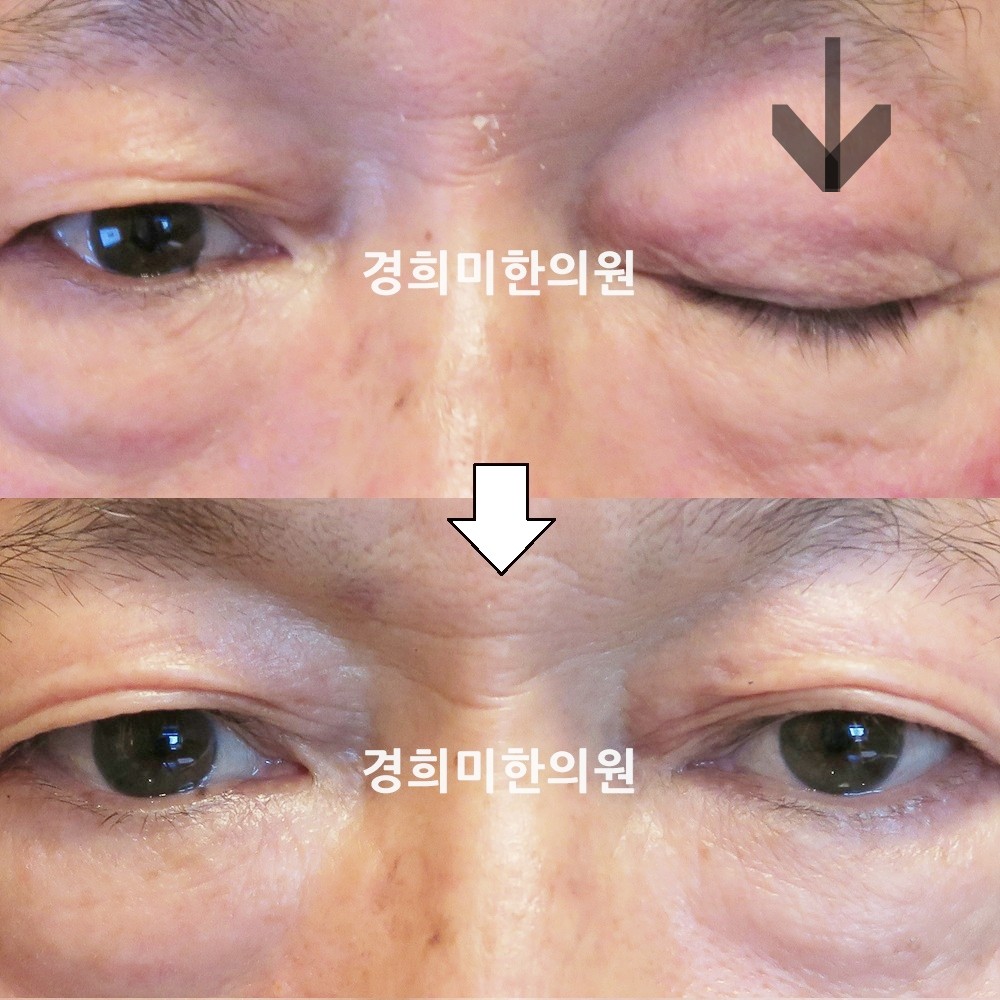 42번-13953-1-강강-표시.jpg