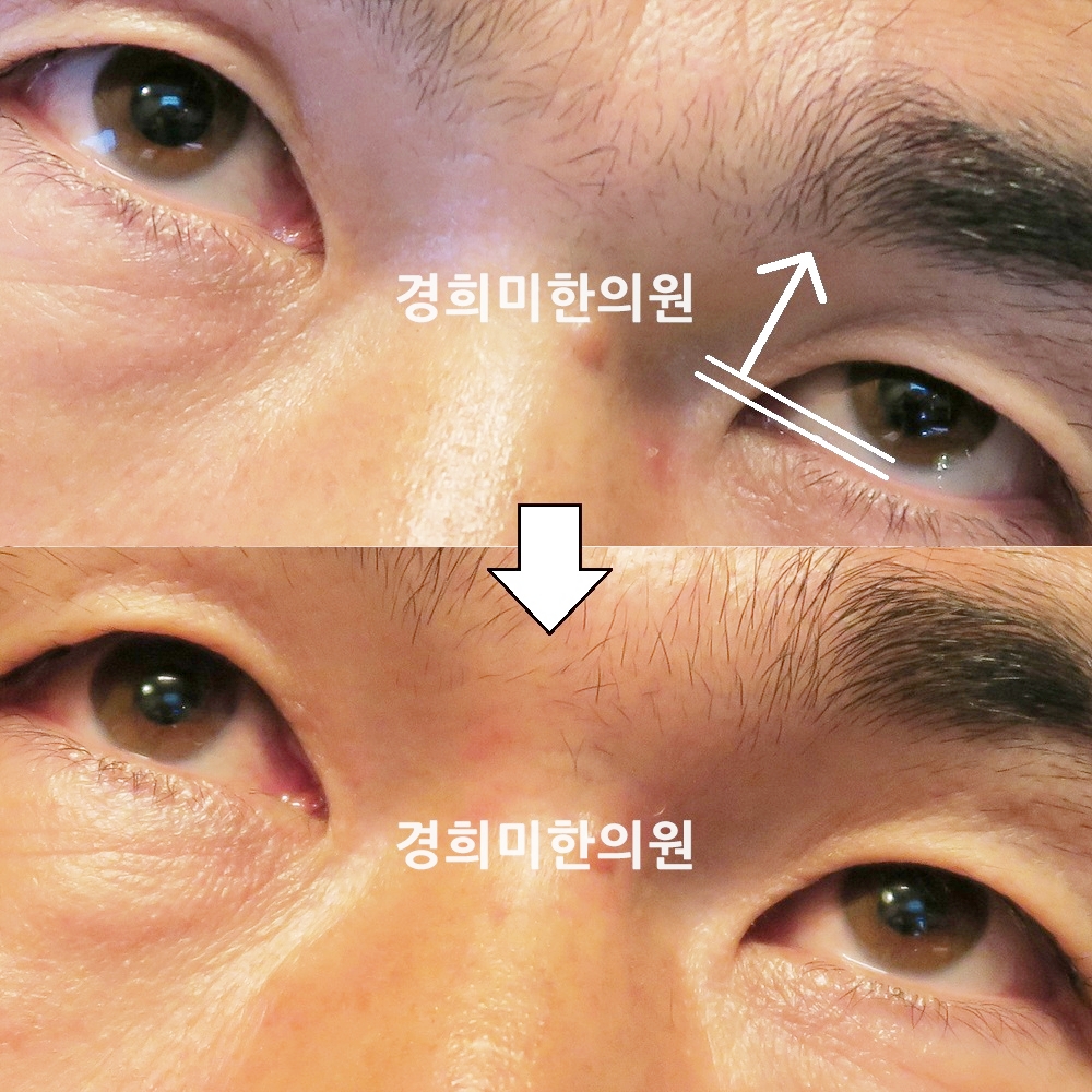 44번-14052-강강.jpg