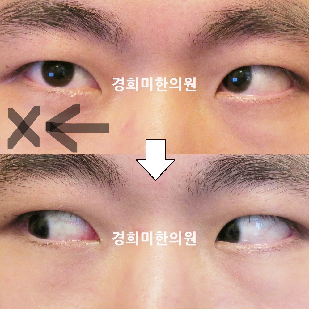47번-14242-강강-표시.jpg