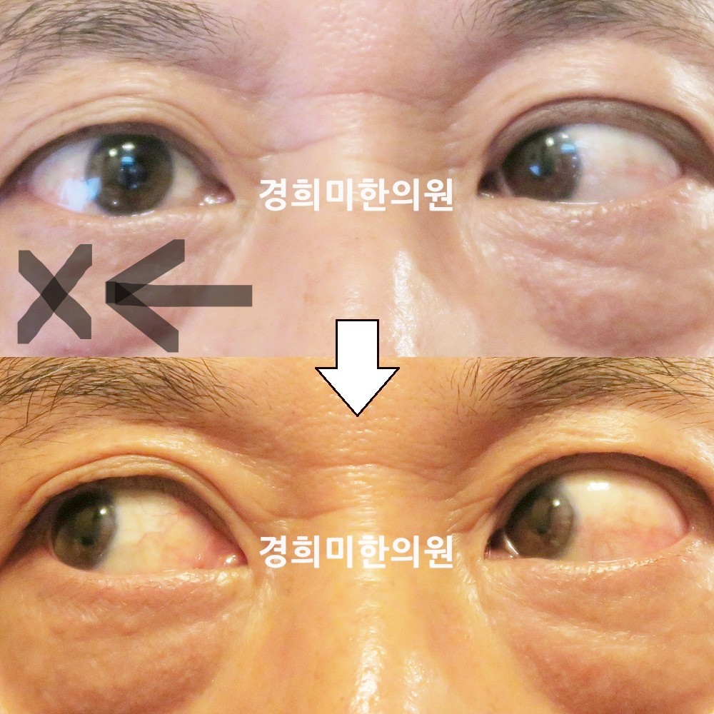 48번-13869-강강중-표시.jpg