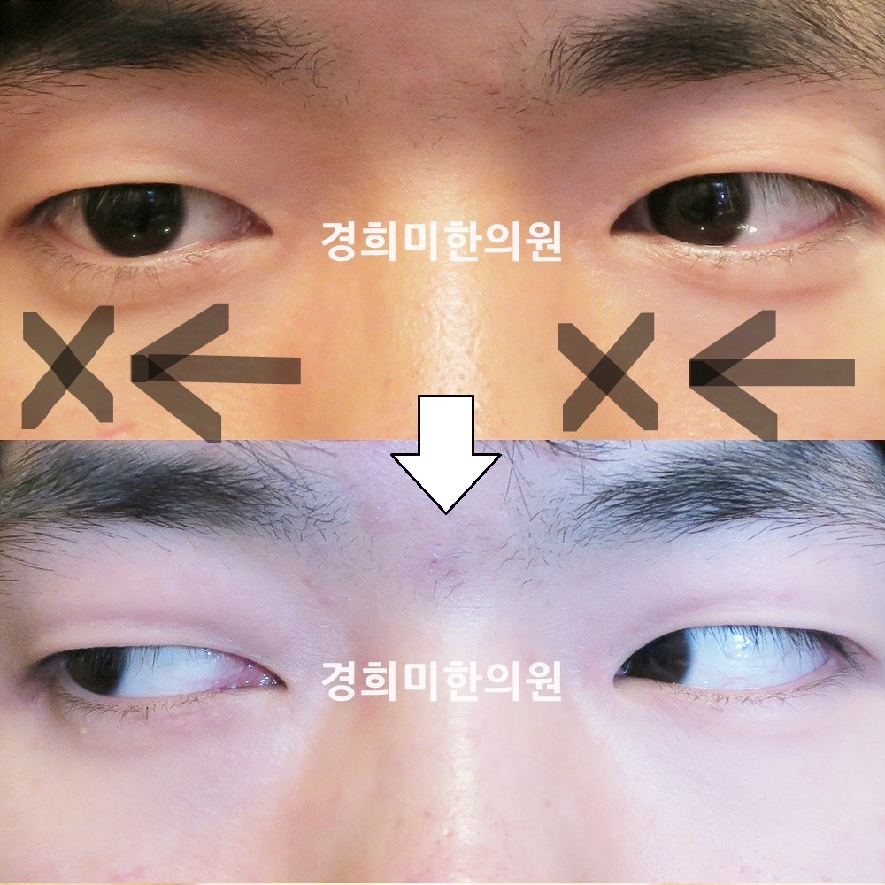49번-14315-1-강강-표시.jpg