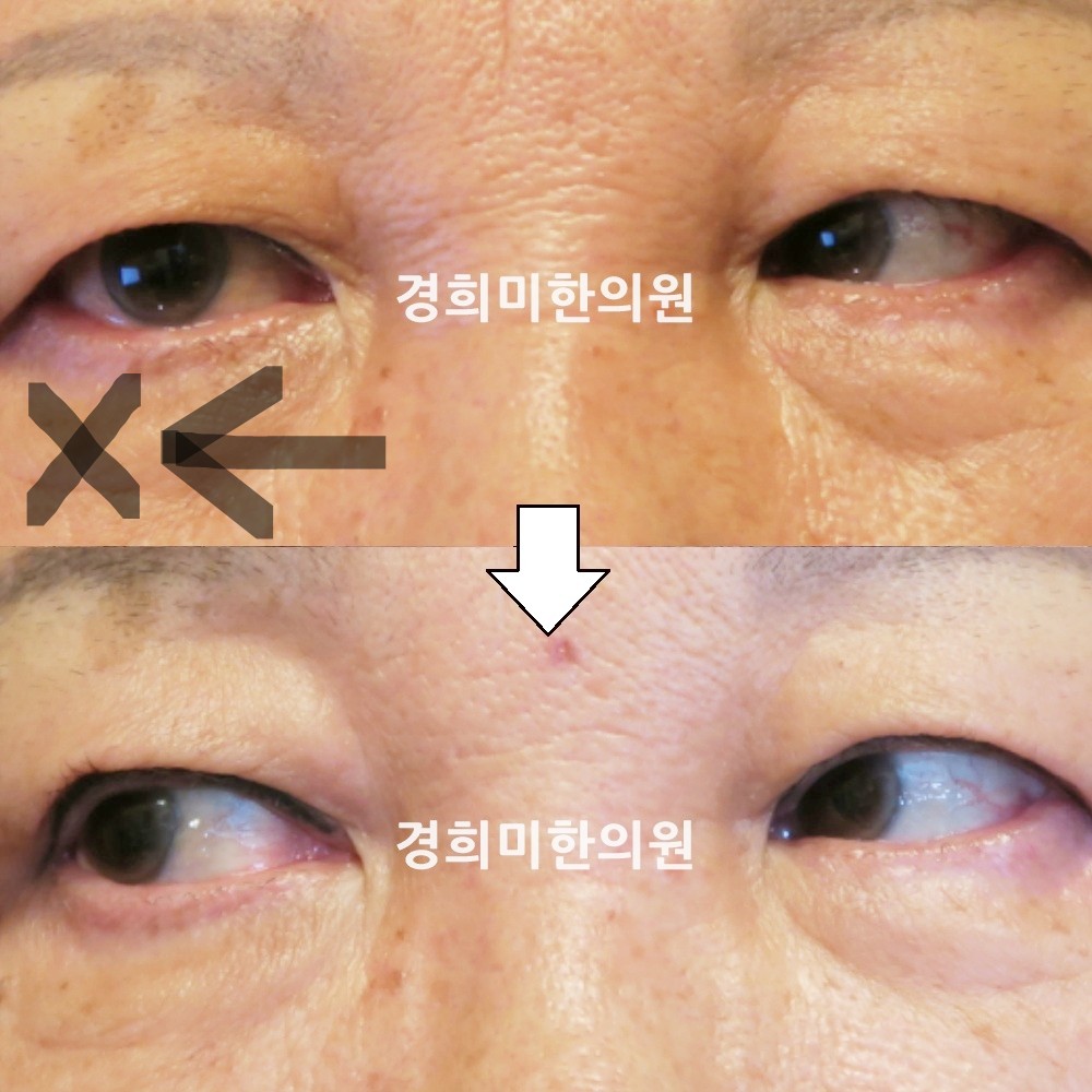51번-14373-강중-표시.jpg