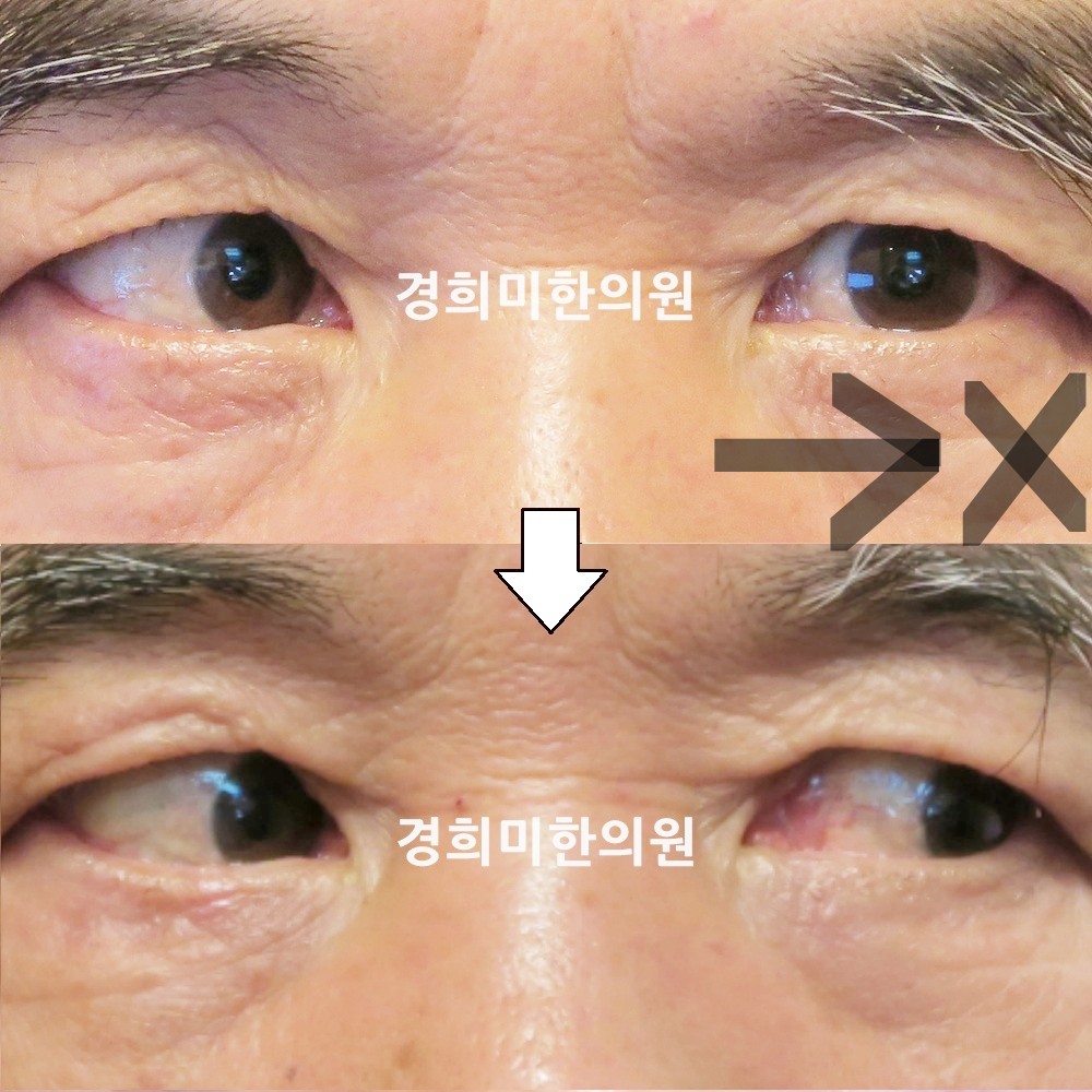 53번-14529-강강약-표시.jpg