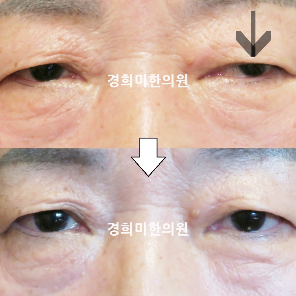 55번-14741-강강-표시.jpg