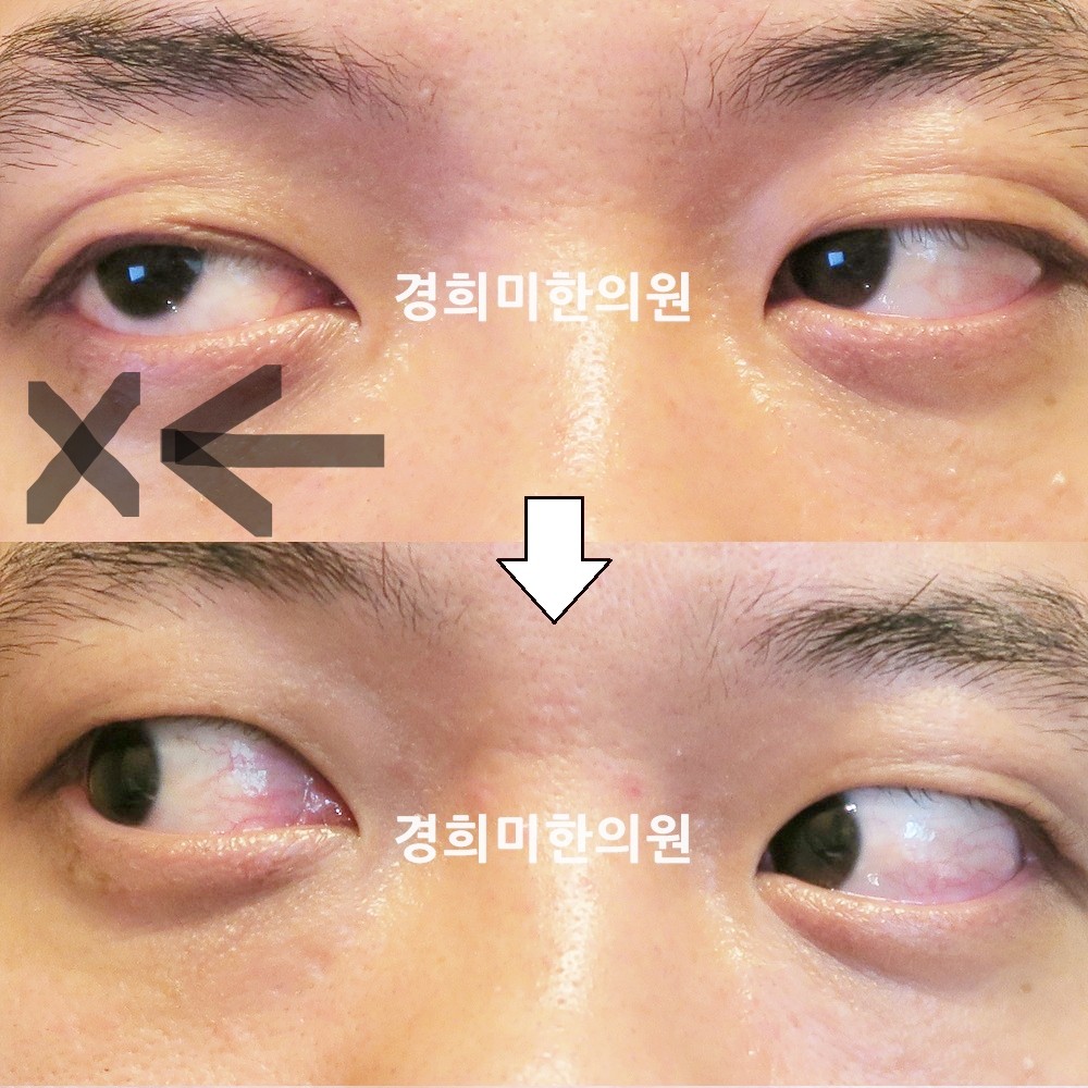 58번-14801-강강중-표시.jpg