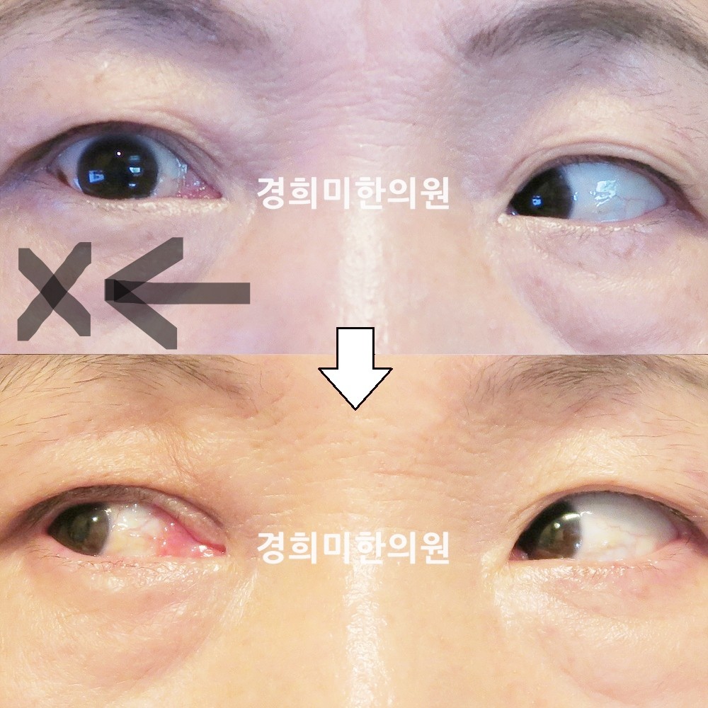 60번-14878-강강약-표시.jpg