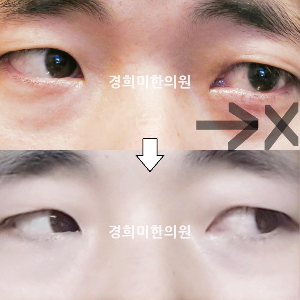 61번-14964-강약-표시.jpg