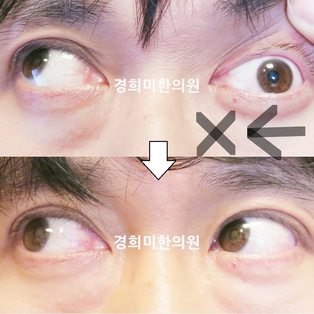 63번-15234-1-강중-표시.jpg