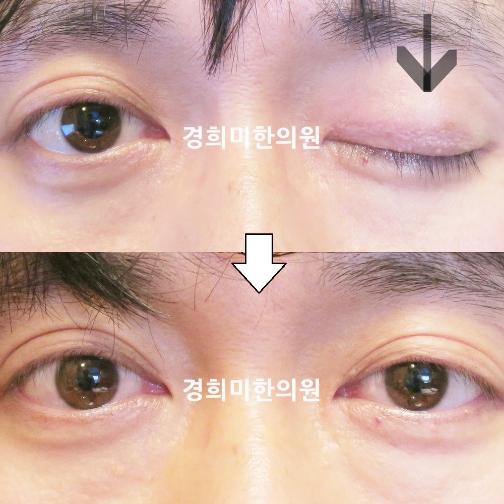 63번-15234-2-강강중-표시.jpg