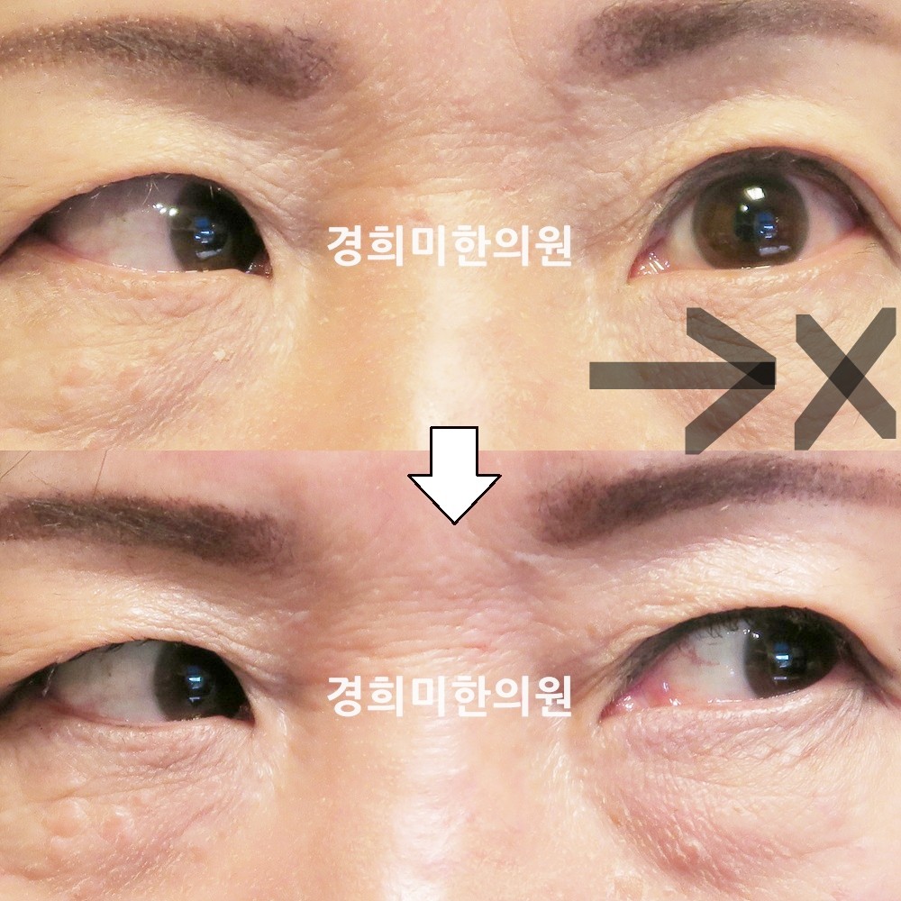 65번-15199-강강약-표시.jpg