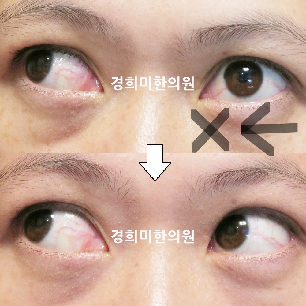 66번-15449-강강약-표시.jpg