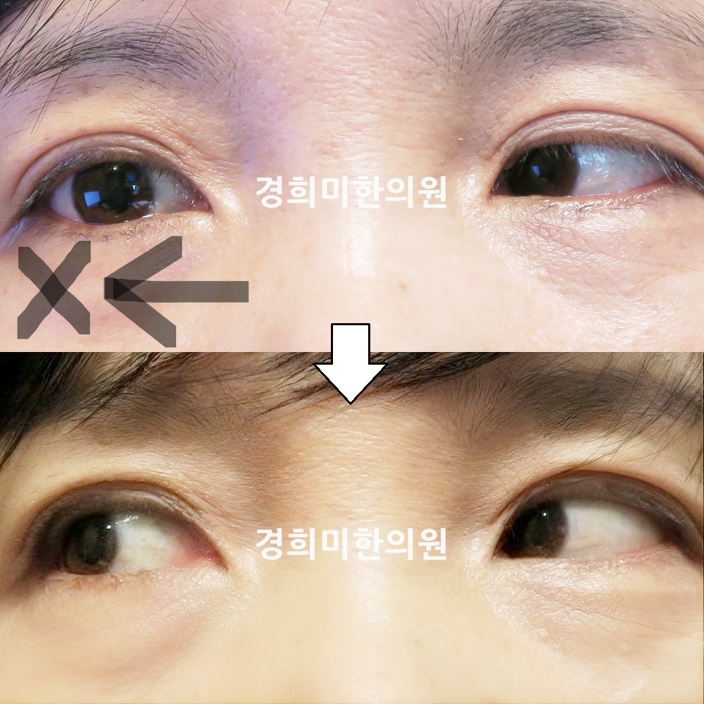 67번-15501-강강-표시.jpg