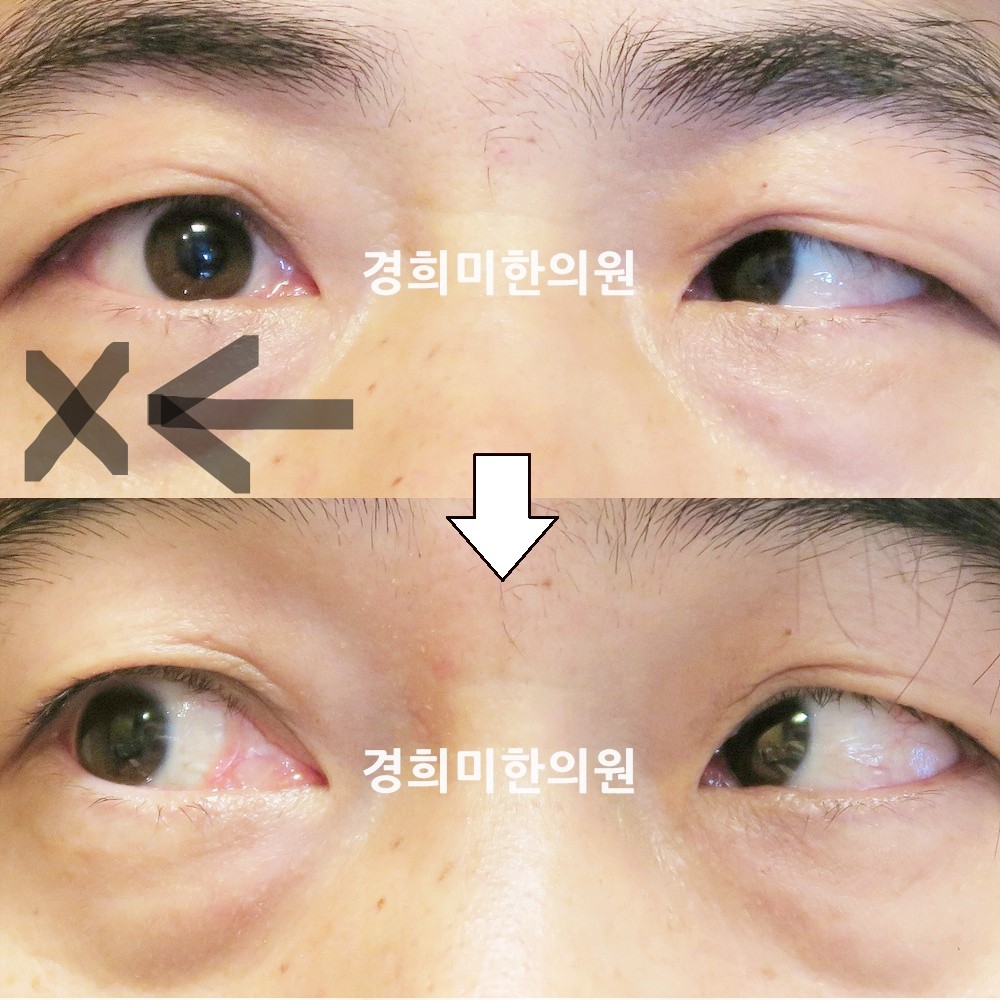 68번-15299-강강중-표시.jpg