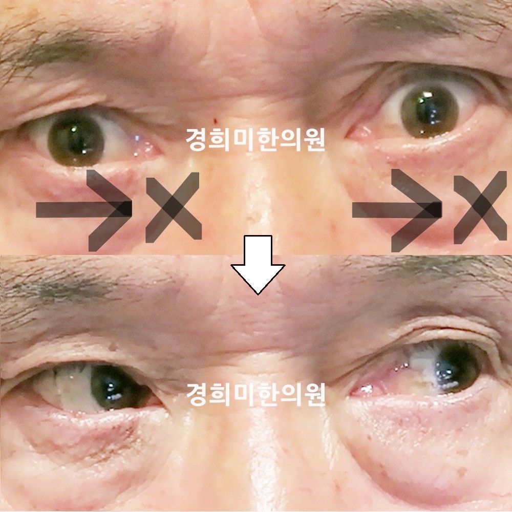 69번-15296-2-강강중-표시.jpg