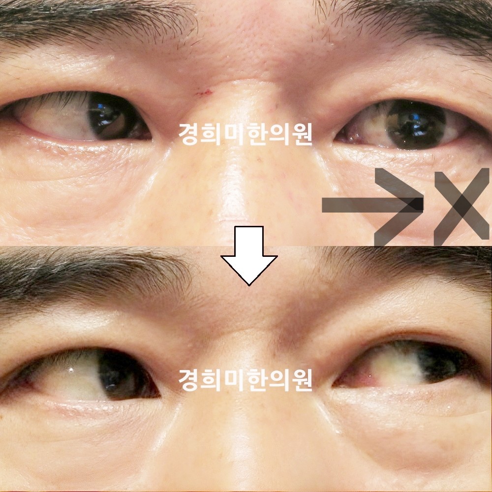 72번-15512-강강중-표시.jpg