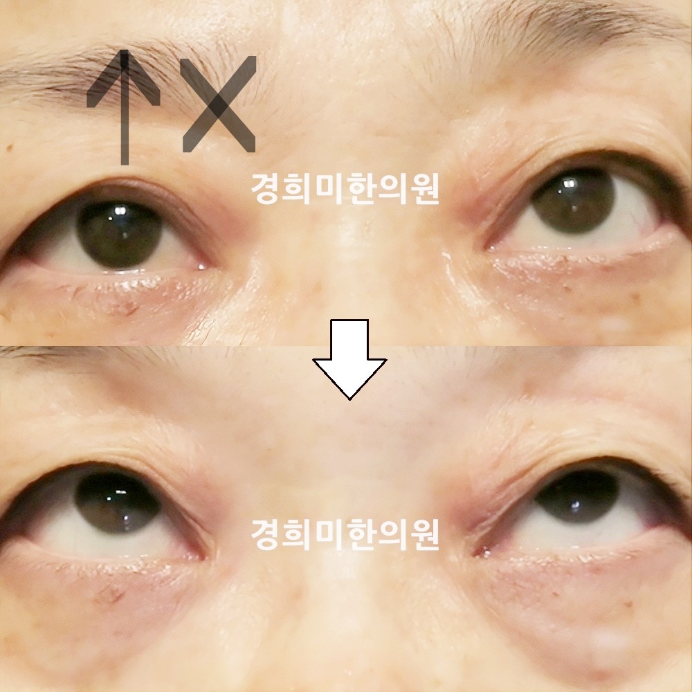 73번-15588-강강약-표시.jpg
