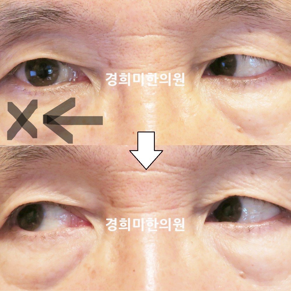 74번-15593-강강중-표시.jpg