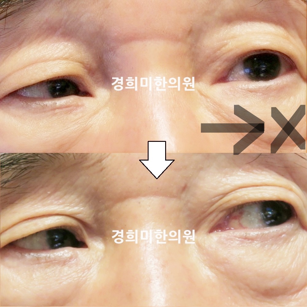 75번-15649-강강약-표시.jpg