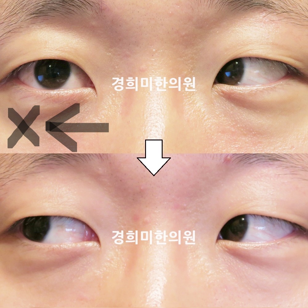 76번-15910-강강약-표시.jpg