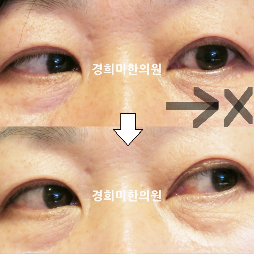 77번-16178-강강약-표시.jpg