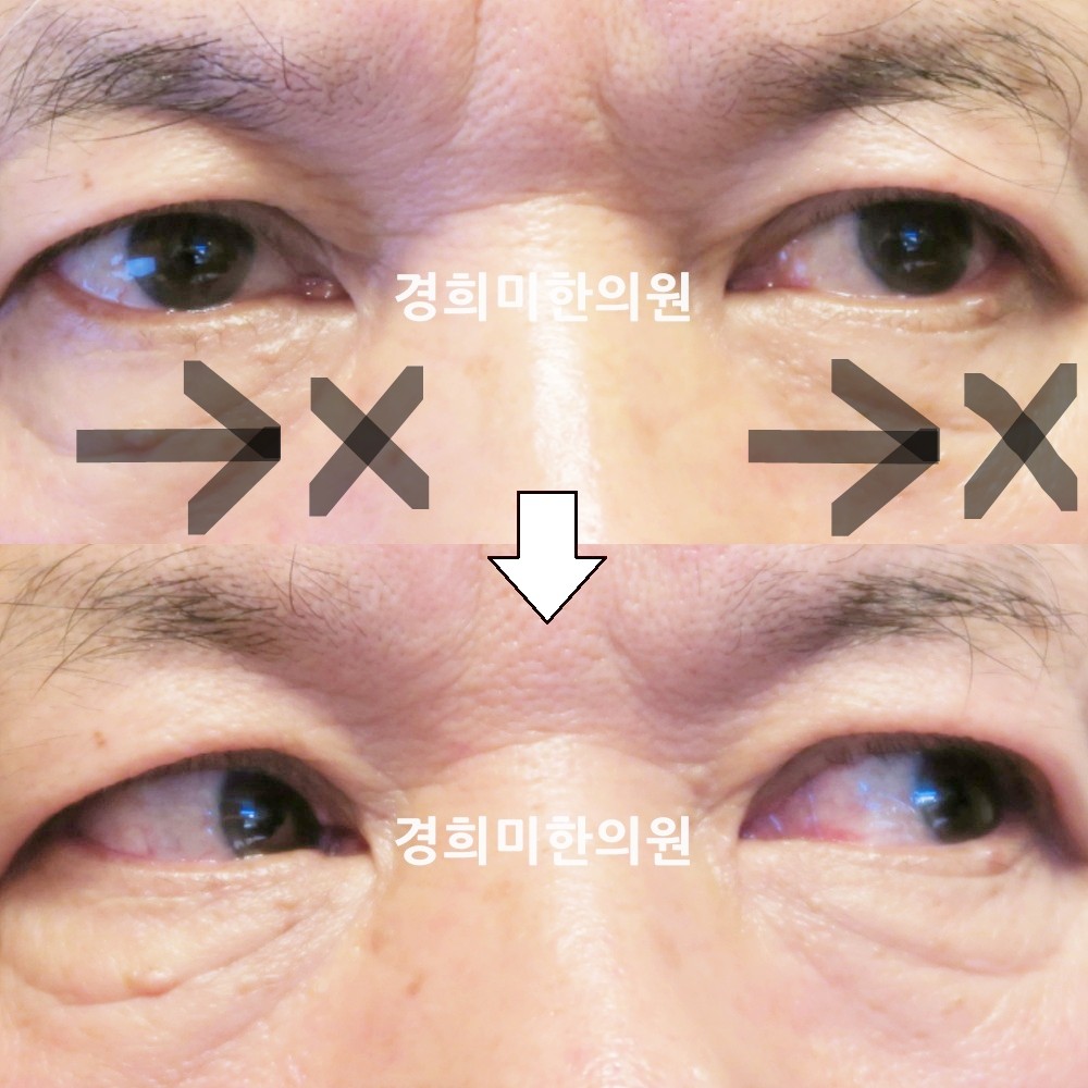 78번-복시-16082-2-강강중-표시.jpg