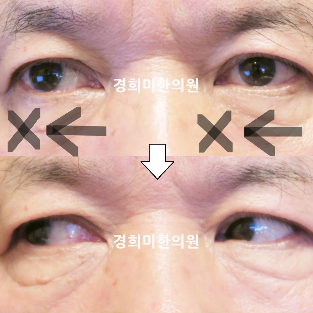 78번-복시-16082-1-강강중-표시.jpg