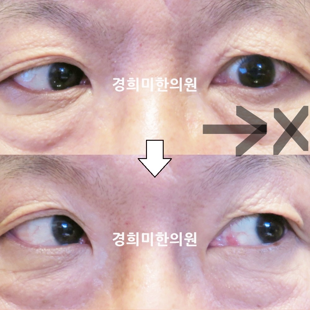 79번-16138-강강중-표시.jpg