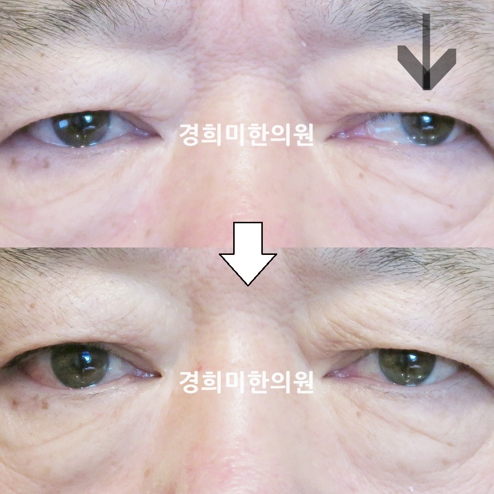 81번-13950-강강중-표시.jpg