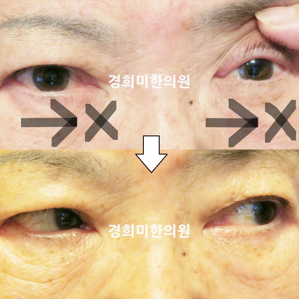 83번-16584-2-강강중-표시.jpg