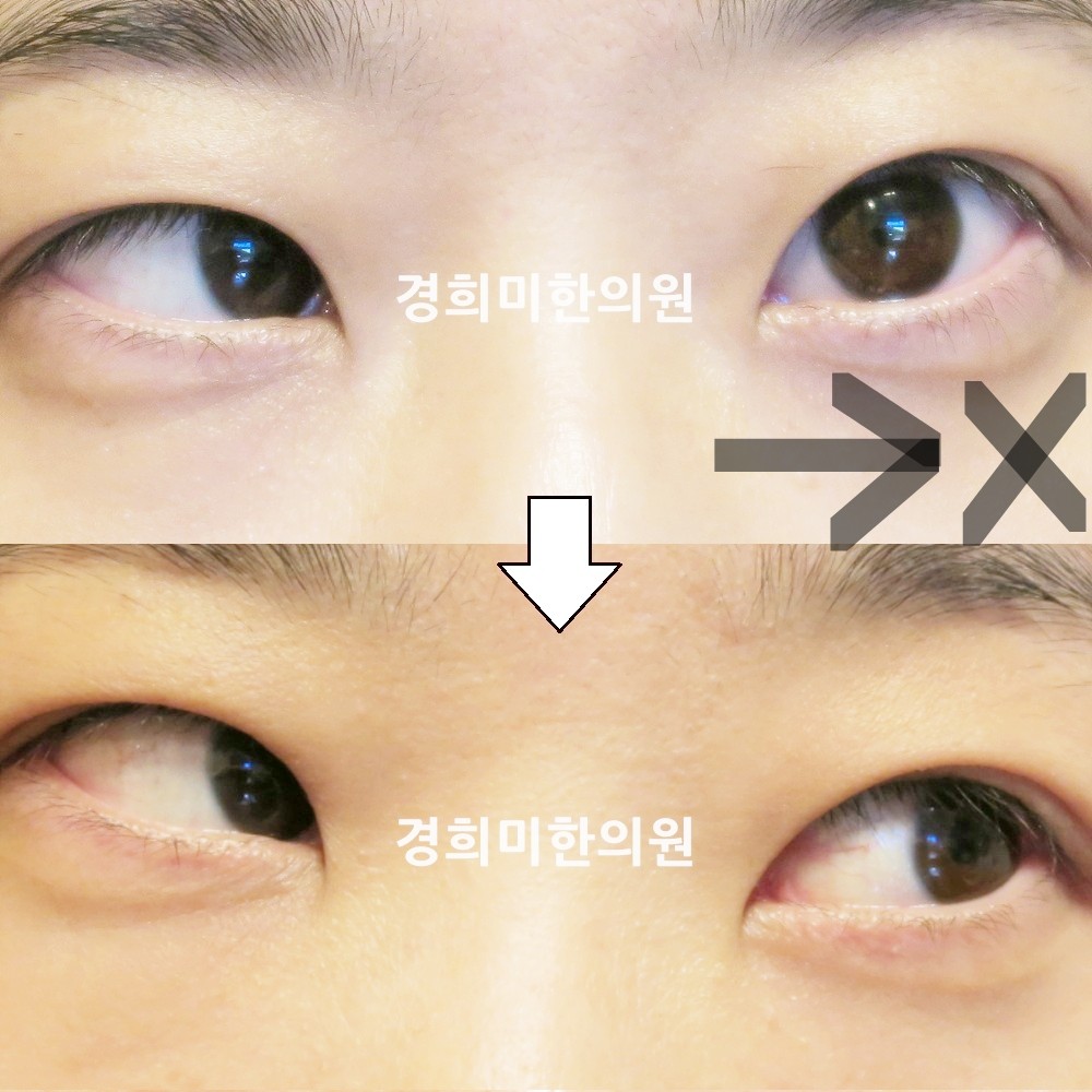 85번-16678-강강중-표시.jpg