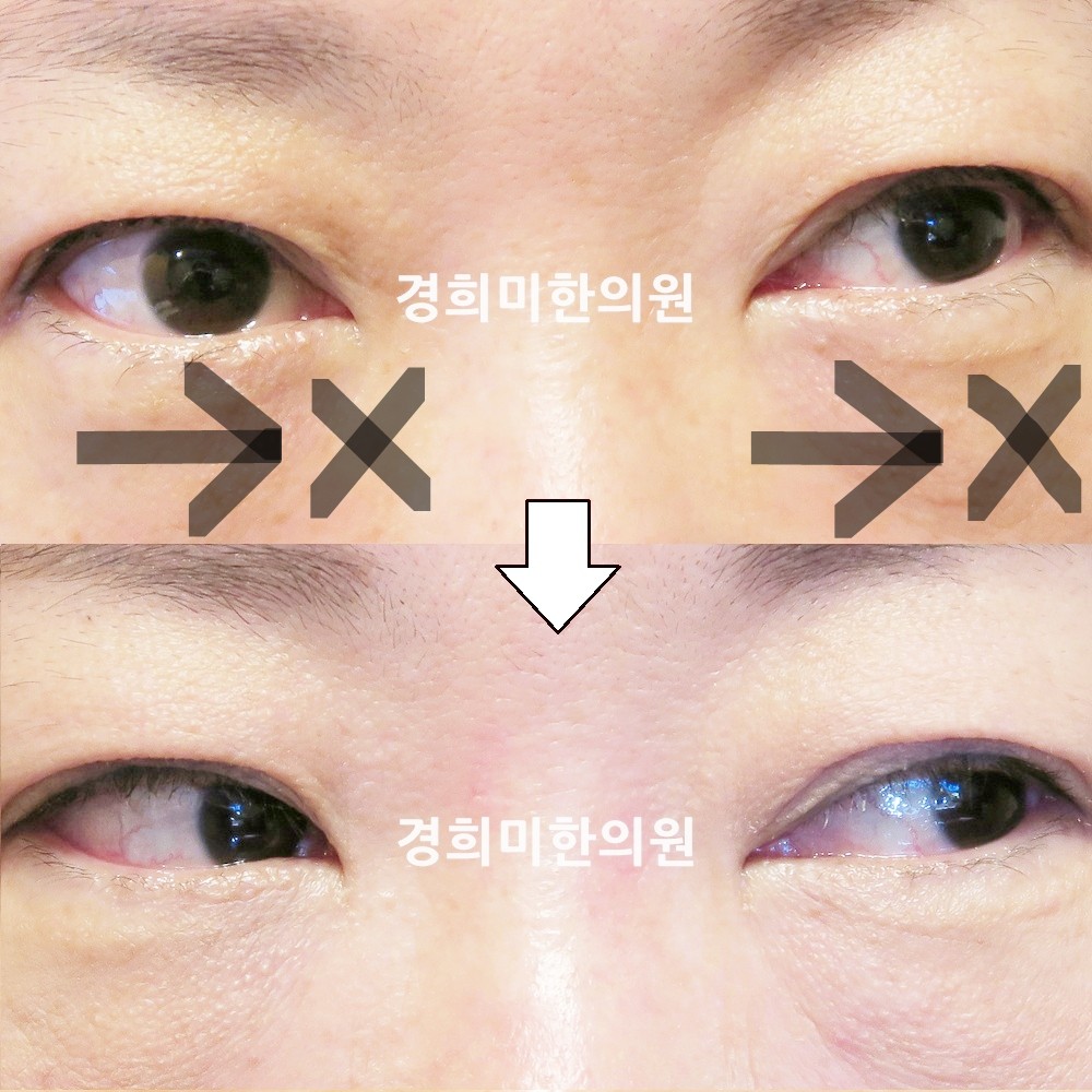 86번-16632-2-강강중-표시.jpg
