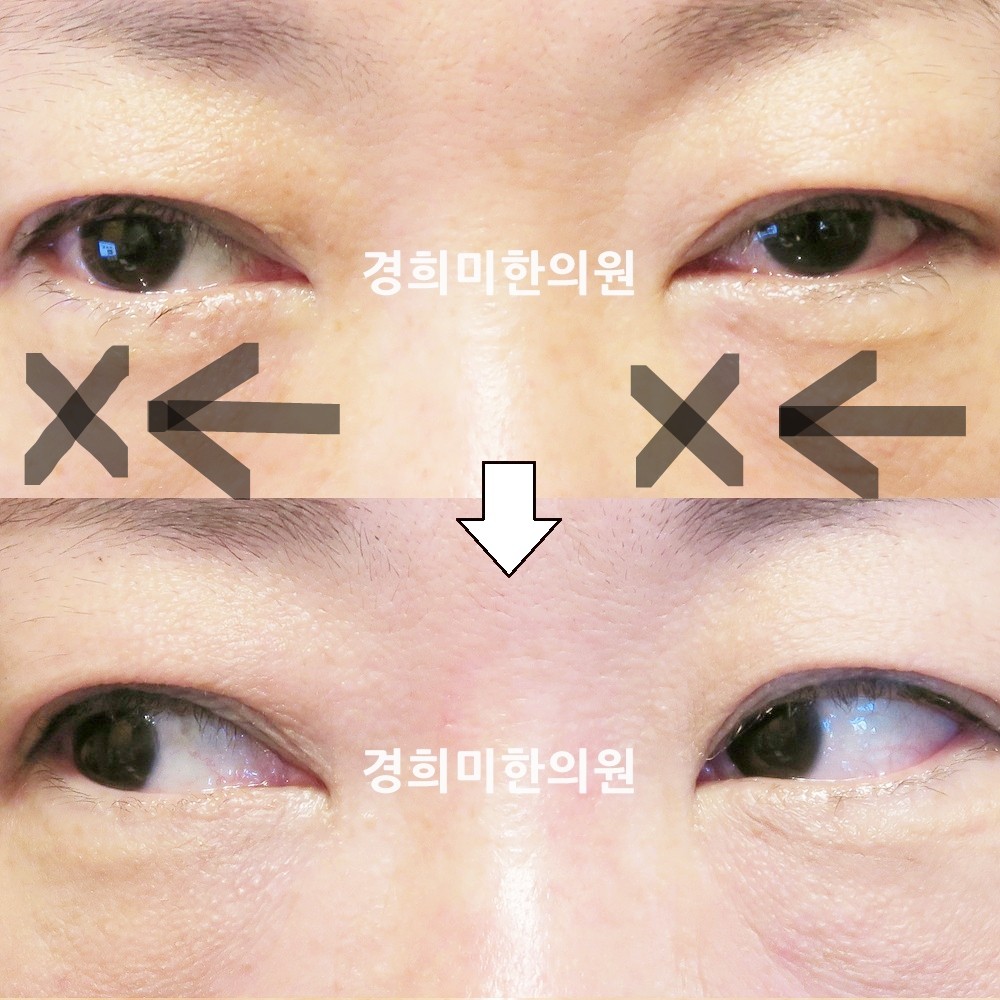 86번-16632-1-강강중-표시.jpg