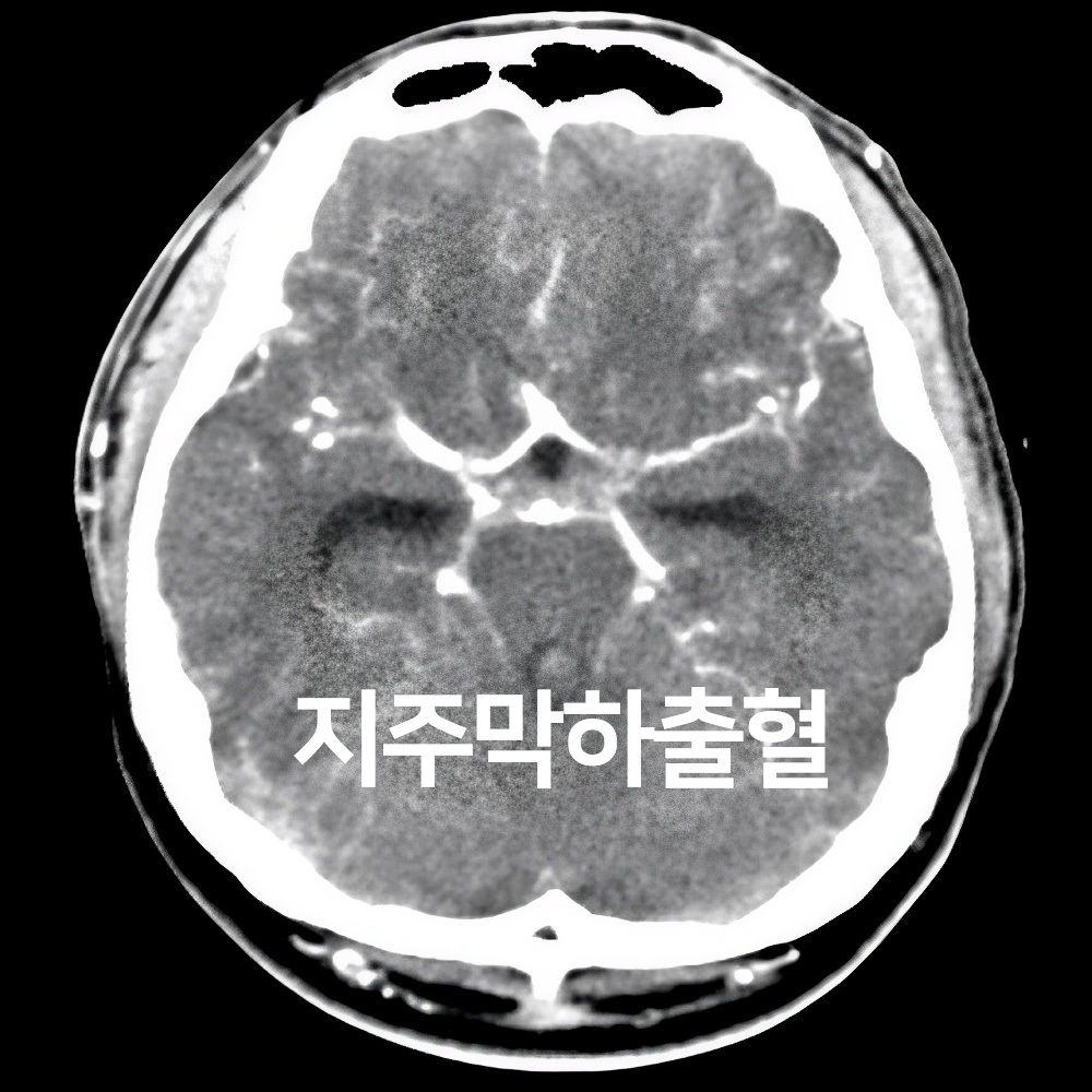 91번-16906-ct3.jpg